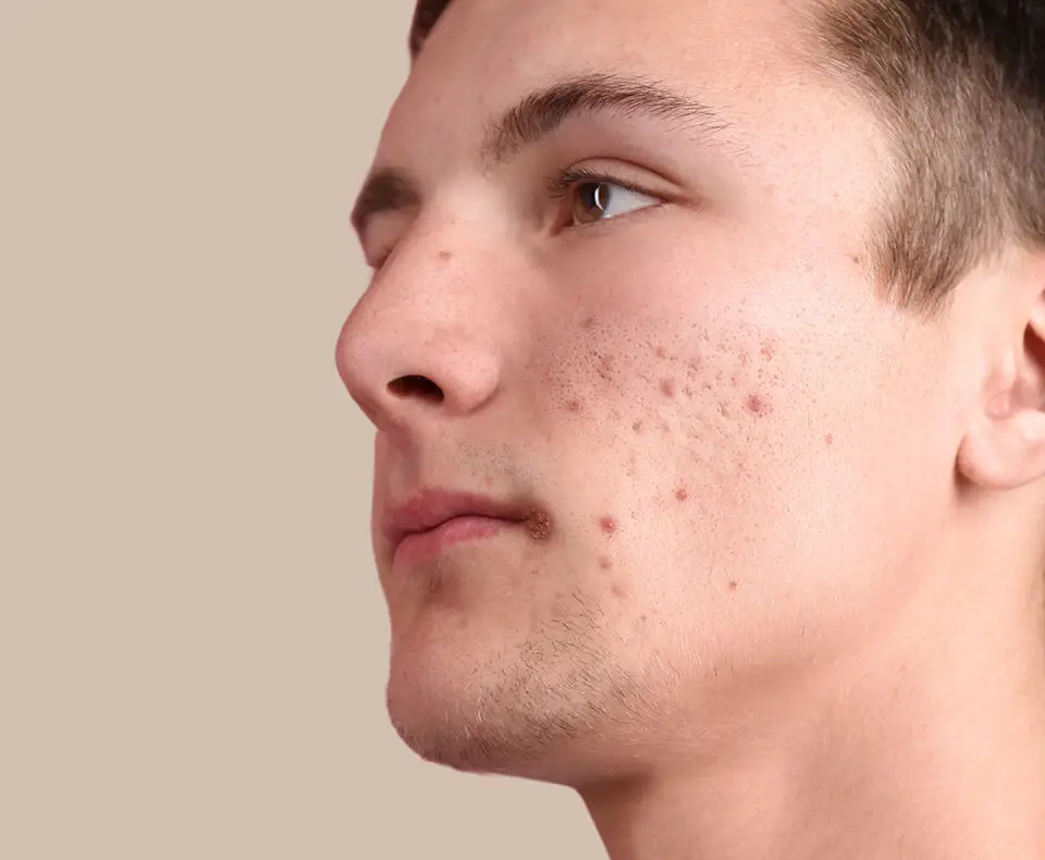 home-1-before-image-three