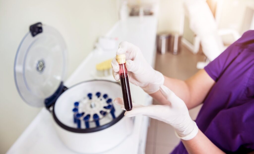Technician holding a blood sample beside a centrifuge for PRP preparation